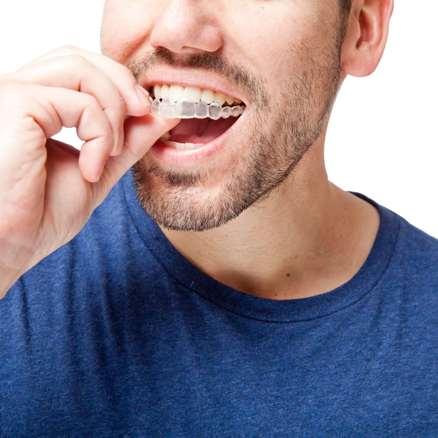 Braces for adults