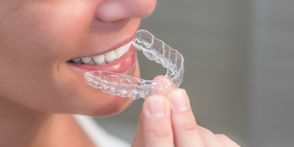 cost of Invisalign for adults