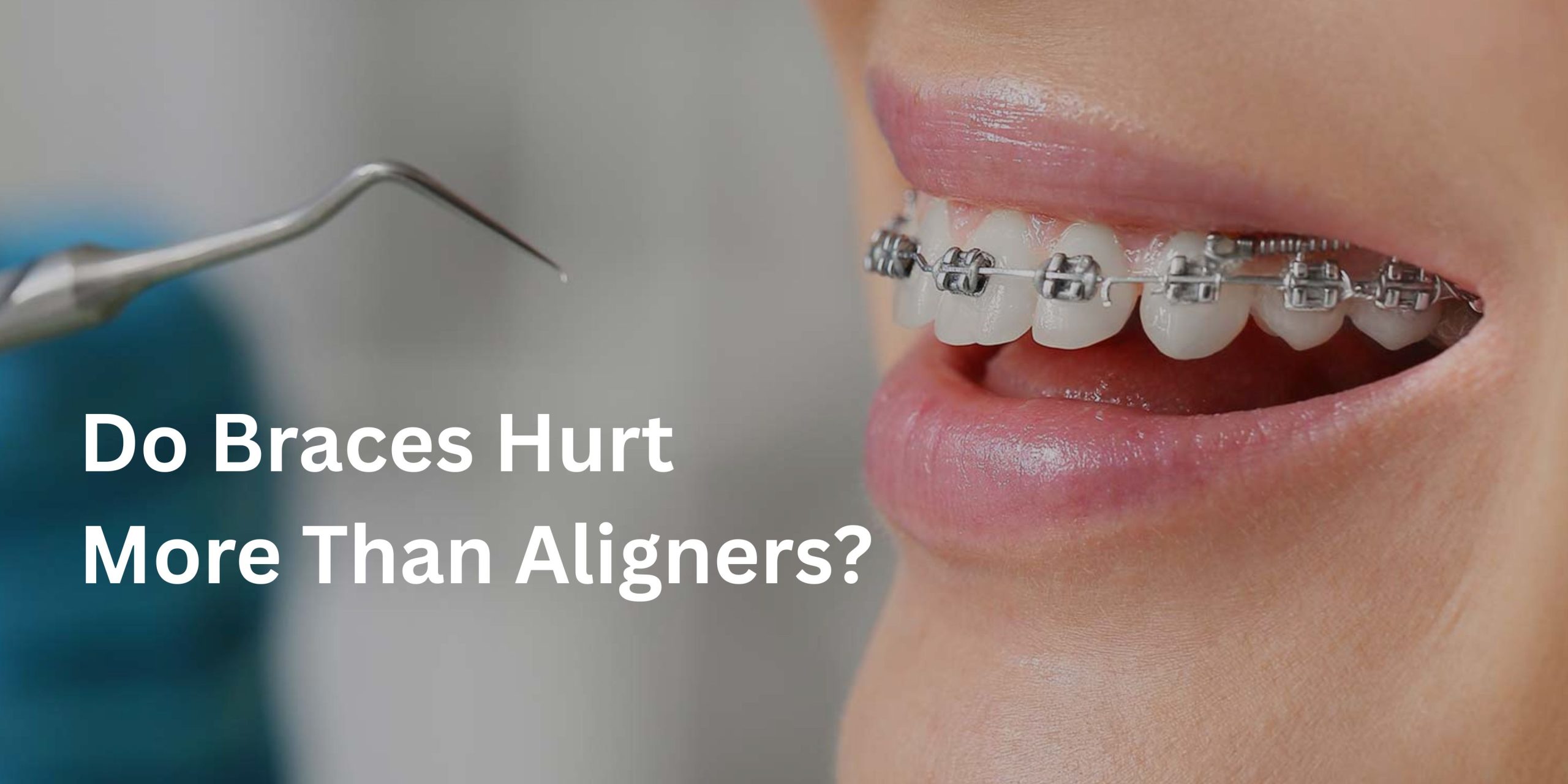Do Braces Hurt
