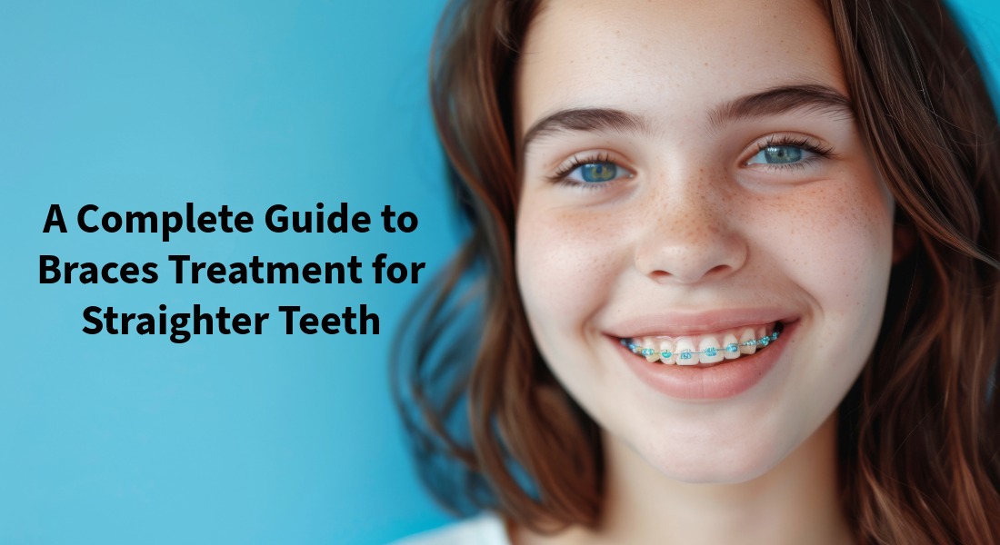 Braces Treatment