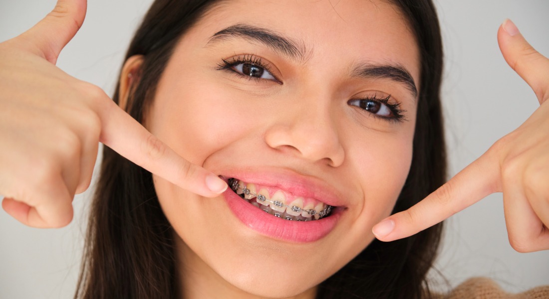 Braces Treatment