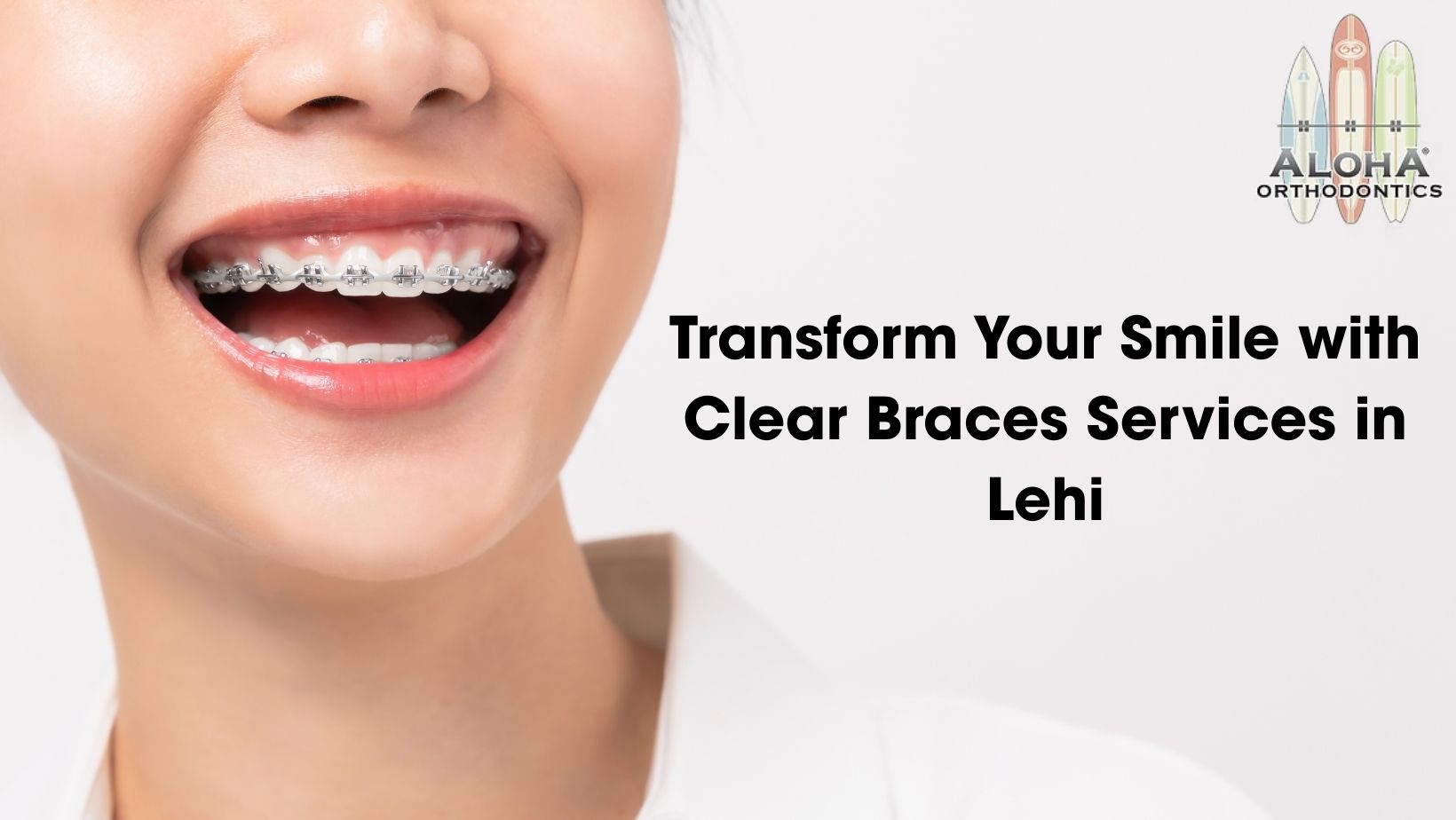 Clear Braces Services in Lehi